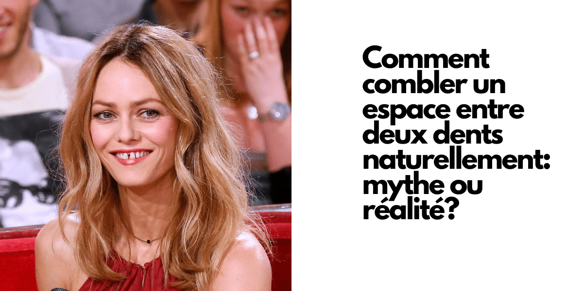 Comment combler un espace entre deux dents naturellement mythe ou réa — free download
