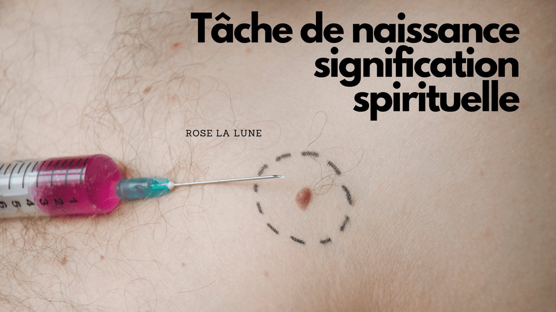 Tache de naissance signification spirituelle