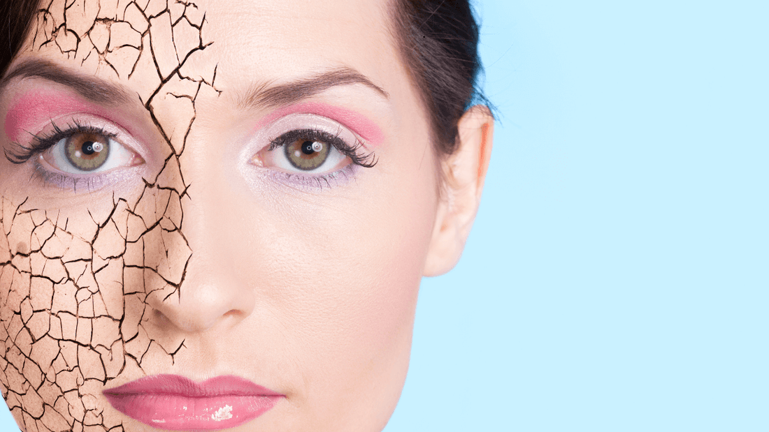 Que faire si vous avez la peau sèche cet été? Les bons réflexes à adopter