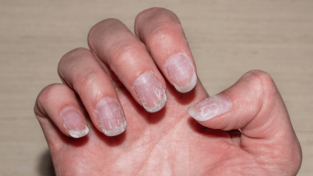 Rêver de se casser un ongle: quelle signification?