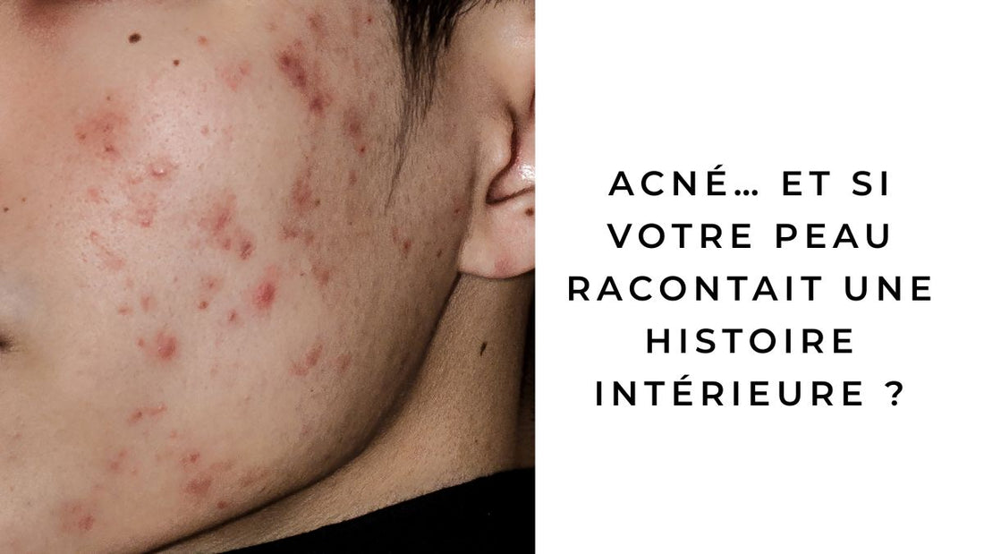acne signification spirituelle