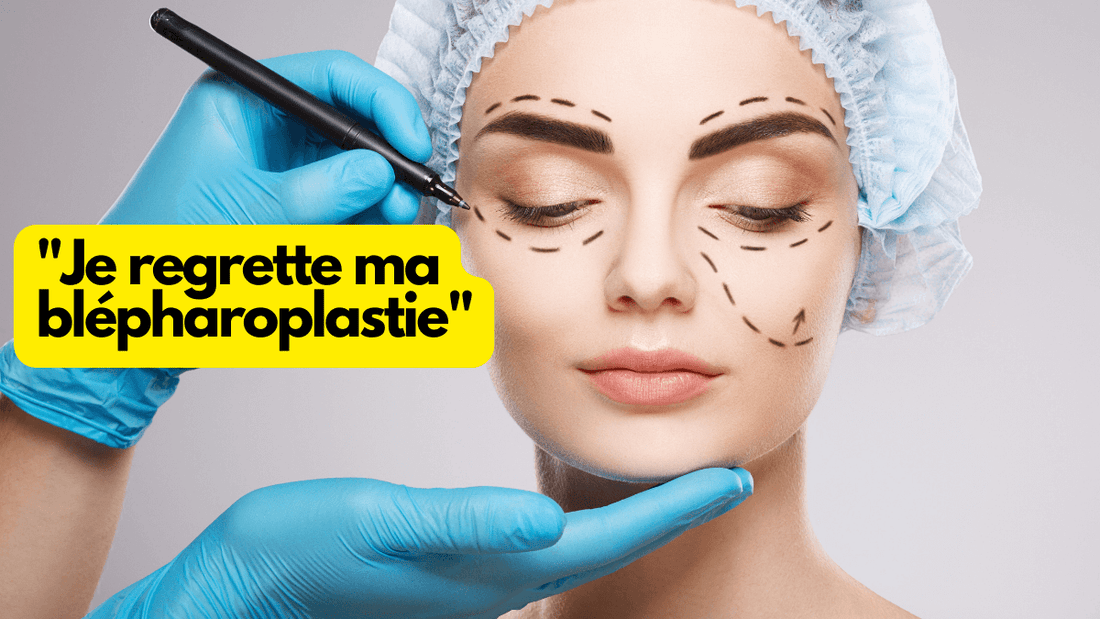 "Je regrette ma blépharoplastie": pourquoi certaines personnes ont des regrets?