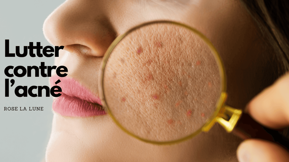Lutter contre l'acné: les solutions