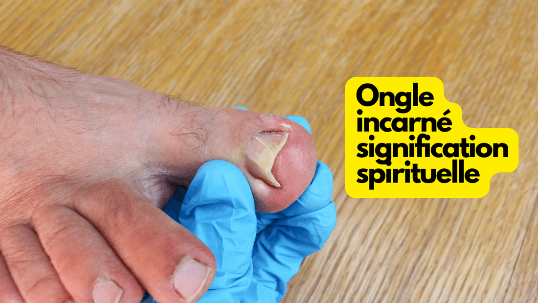 Ongle incarné signification spirituelle