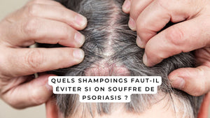 Quels shampoings faut-il éviter si on souffre de psoriasis ?