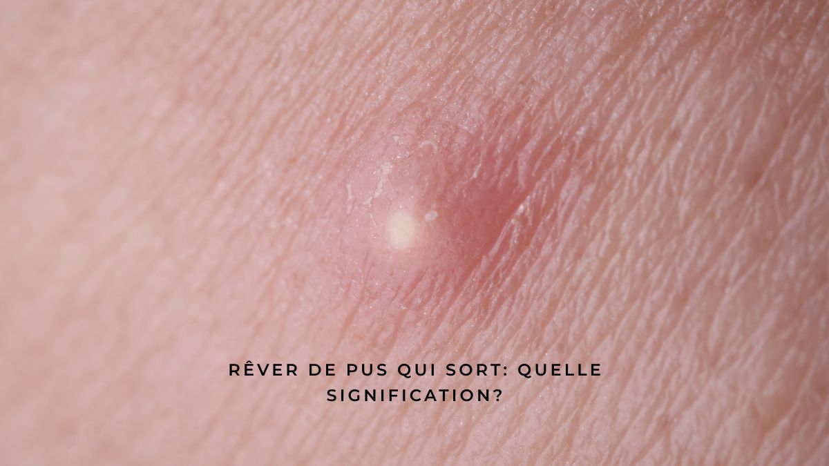 Rêver de pus qui sort: quelle signification? – Rose La Lune