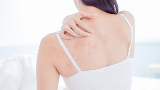 Eczema signification spirituelle