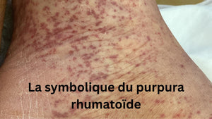 La symbolique du purpura rhumatoïde : quand le corps dessine ses propres messages