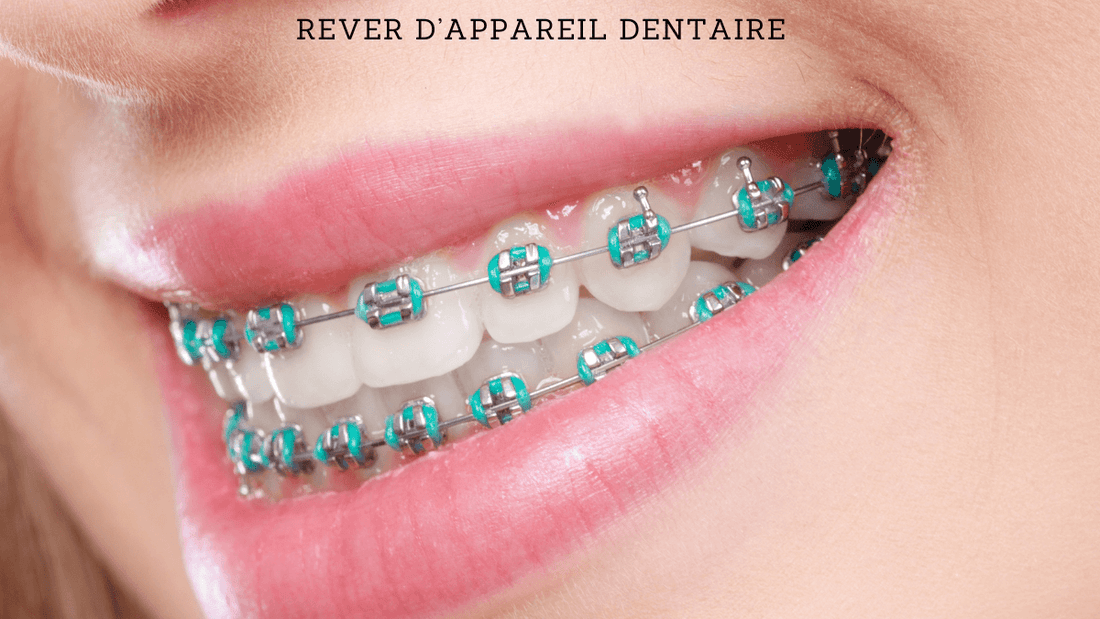 Voici 5 significations si vous rêvez d'appareil dentaire
