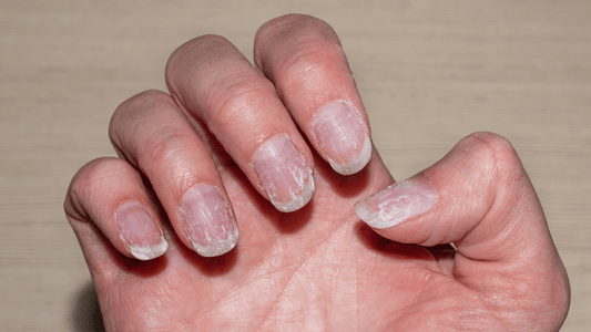 Rêver de se casser un ongle: quelle signification?